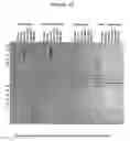 Fig. 17 - Reagents and methods useful for detecting diseases of the breast