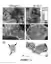 Fig. 03 - CEA/NCA-based differentiation cancer therapy