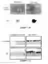 Fig. 04 - CEA/NCA-based differentiation cancer therapy