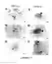 Fig. 07 - CEA/NCA-based differentiation cancer therapy