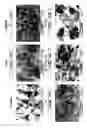Fig. 12 - CEA/NCA-based differentiation cancer therapy