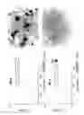 Fig. 15 - CEA/NCA-based differentiation cancer therapy