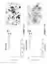 Fig. 16 - CEA/NCA-based differentiation cancer therapy