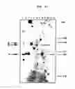 Fig. 14 - Superantigens SMEZ-2, SPE-G, SPE-H and SPE-J and uses thereof