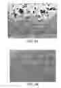 Fig. 03 - Method and apparatus for in vivo collection of circulating biological components