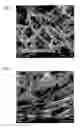 Fig. 02 - Novel Pseudonocardia sp. RMRC PAH4 and a process for bioconverting compactin into pravastatin using the same