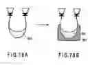 Fig. 65 - Nucleic acid detecting cassette, nucleic and detecting apparatus utilizing nucleic acid detecting cassette, and nucleic acid detecting system utilizing nucleic acid detecting cassette