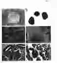 Fig. 03 - Methods for assaying gene imprinting and methylated cpg islands