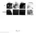 Fig. 06 - Adipose-derived stem cells and lattices
