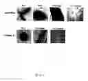 Fig. 07 - Adipose-derived stem cells and lattices