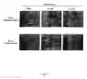 Fig. 17 - Adipose-derived stem cells and lattices