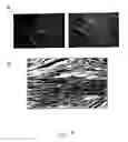 Fig. 19 - Adipose-derived stem cells and lattices