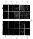 Fig. 24 - Adipose-derived stem cells and lattices