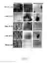 Fig. 37 - Adipose-derived stem cells and lattices
