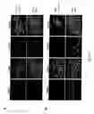 Fig. 42 - Adipose-derived stem cells and lattices