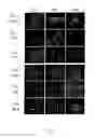 Fig. 47 - Adipose-derived stem cells and lattices