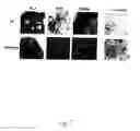 Fig. 06 - Adipose-derived stem cells and lattices