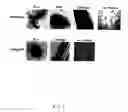 Fig. 07 - Adipose-derived stem cells and lattices