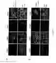 Fig. 45 - Adipose-derived stem cells and lattices