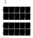 Fig. 68 - Adipose-derived stem cells and lattices