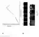 Fig. 71 - Adipose-derived stem cells and lattices