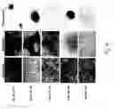 Fig. 74 - Adipose-derived stem cells and lattices