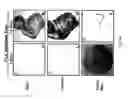 Fig. 76 - Adipose-derived stem cells and lattices