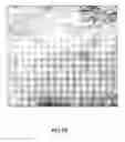 Fig. 82 - Adipose-derived stem cells and lattices