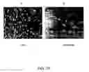 Fig. 84 - Adipose-derived stem cells and lattices