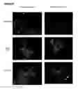 Fig. 11 - System for expanding and differentiating human embryonic stem cells
