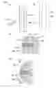Fig. 06 - Polisher brush having wire-shaped grinding elements