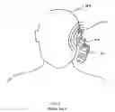 Fig. 02 - Magnetic field device
