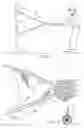 Fig. 02 - Extended-use ball striking training device