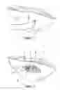 Fig. 02 - Injection formulation