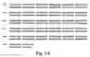 Fig. 04 - Vascular endothelial growth factor-x
