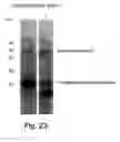 Fig. 50 - Vascular endothelial growth factor-x