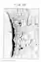 Fig. 09 - Compound B as an angiogenic agent in combination with human growth factors