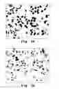 Fig. 06 - Compound and method for treating androgen-independent prostate cancer