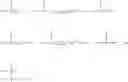 Fig. 77 - Methods for inhibiting sterol absorption