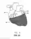Fig. 02 - Cardiac harness having interconnected strands