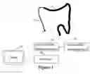 Fig. 02 - Magnetically guided colonoscope