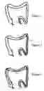 Fig. 03 - Magnetically guided colonoscope