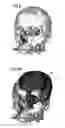 Fig. 06 - Method and control device to operate a magnetic resonance tomography apparatus