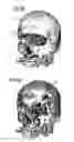 Fig. 07 - Method and control device to operate a magnetic resonance tomography apparatus