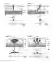 Fig. 06 - System and method of mapping irregularities of hard tissue