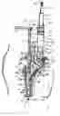 Fig. 01 - Minimally invasive bone miller apparatus