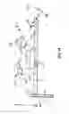 Fig. 08 - Minimally invasive bone miller apparatus