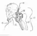Fig. 01 - Cervical orthosis
