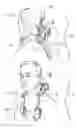 Fig. 02 - Cervical orthosis