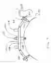 Fig. 07 - Cervical orthosis